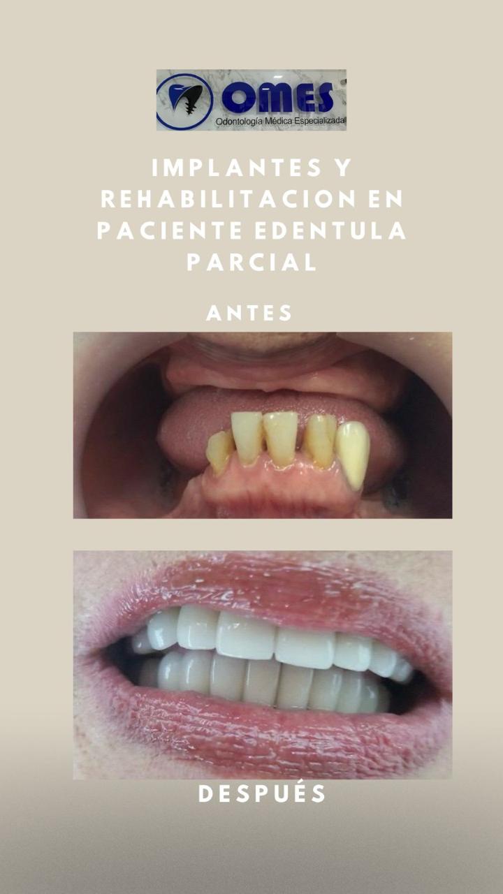 Contenido clínico oculto hasta confirmar visualización